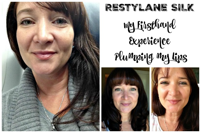 What's Her Secret? My Firsthand Experience With Restylane Lyft and Restylane Silk