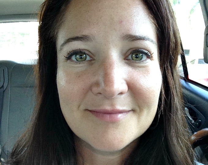 What's Her Secret? My Firsthand Experience With Restylane Lyft and Restylane Silk